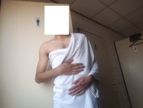 body-2