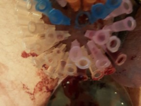 20161010_000026